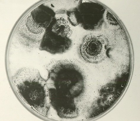 Cytospora chrysosperma (culture) on Populus.